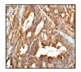 Immunohistochemistry (Formalin/PFA-fixed paraffin-embedded sections) - Anti-GOSR1/GS28 antibody [EP1768Y] (AB53288)