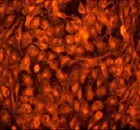 Immunocytochemistry/ Immunofluorescence - Anti-GOSR1/GS28 antibody [EP1768Y] - BSA and Azide free (AB232339)