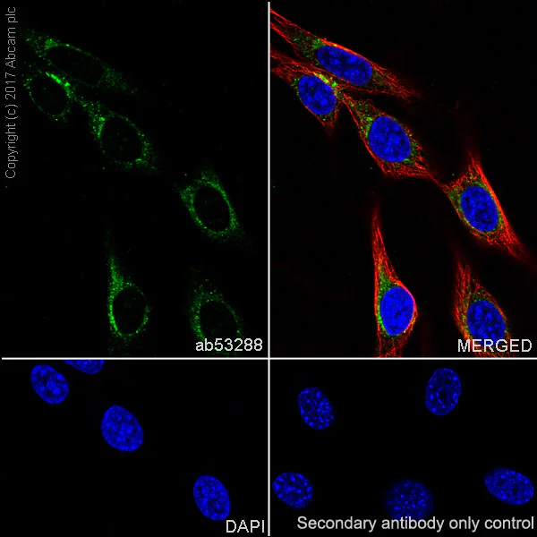 Immunocytochemistry/ Immunofluorescence - Anti-GOSR1/GS28 antibody [EP1768Y] - BSA and Azide free (AB232339)