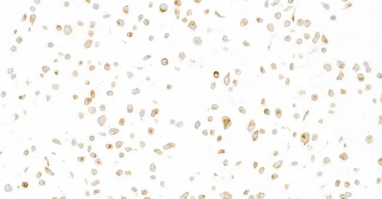 Immunocytochemistry - Anti-GP130/CD130 antibody [BLR114H] - BSA free (AB314107)