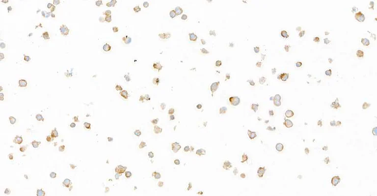 Immunocytochemistry - Anti-GP130/CD130 antibody [BLR114H] - BSA free (AB314107)