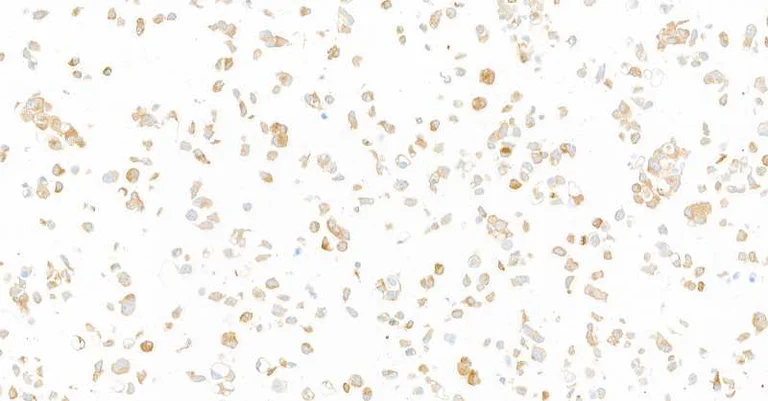 Immunocytochemistry - Anti-GP130/CD130 antibody [BLR114H] - BSA free (AB314107)