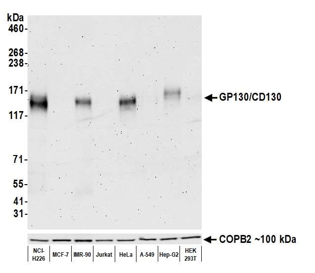 Western blot - Anti-GP130/CD130 antibody [BLR114H] - BSA free (AB314107), expandable thumbnail