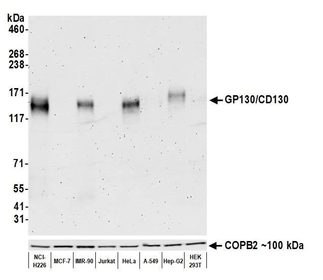 Western blot - Anti-GP130/CD130 antibody [BLR114H] - BSA free (AB314107)