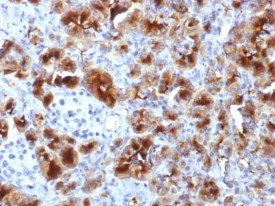 Immunohistochemistry (Formalin/PFA-fixed paraffin-embedded sections) - Anti-GP2 antibody [GP2/1712] (AB218410)