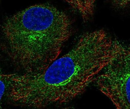 Immunocytochemistry/ Immunofluorescence - Anti-gp78 antibody (AB222051), expandable thumbnail