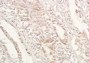 Immunohistochemistry (Formalin/PFA-fixed paraffin-embedded sections) - Anti-GPA33 antibody (AB203286)