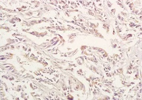 Immunohistochemistry (Formalin/PFA-fixed paraffin-embedded sections) - Anti-GPA33 antibody (AB203286)