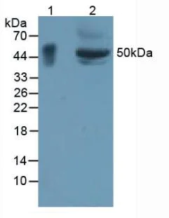 Western blot - Anti-GPA33 antibody (AB231592)