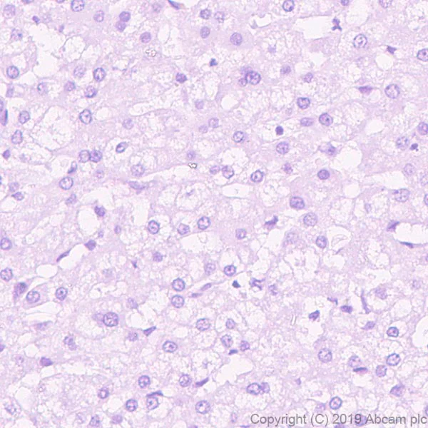 Immunohistochemistry (Formalin/PFA-fixed paraffin-embedded sections) - Anti-GPA33 antibody [EPR23115-67] (AB267387)
