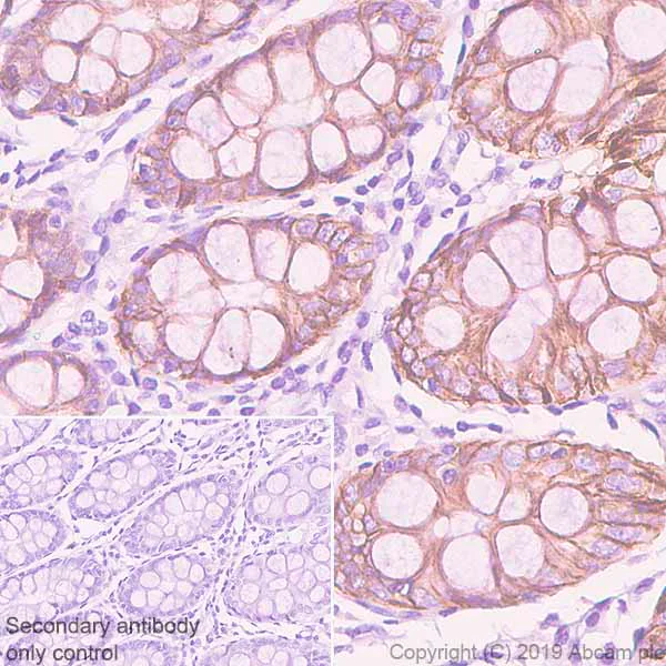 Immunohistochemistry (Formalin/PFA-fixed paraffin-embedded sections) - Anti-GPA33 antibody [EPR23115-67] - BSA and Azide free (AB267390)