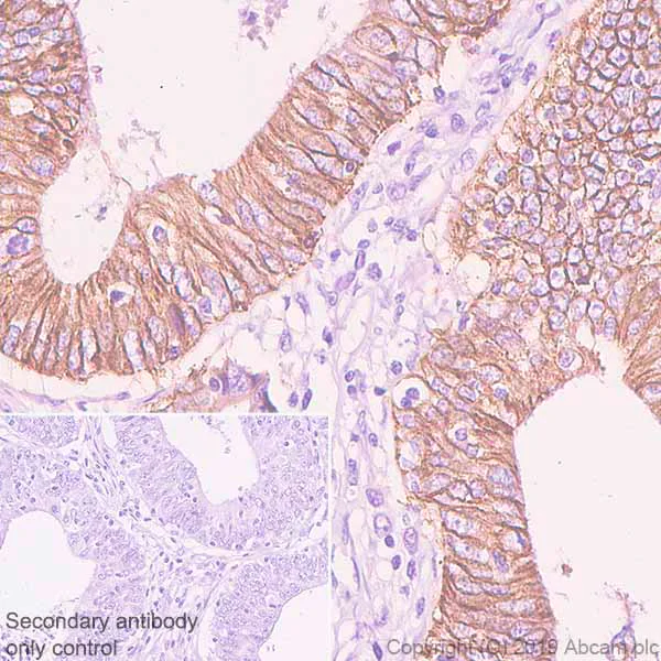 Immunohistochemistry (Formalin/PFA-fixed paraffin-embedded sections) - Anti-GPA33 antibody [EPR23115-67] - BSA and Azide free (AB267390)