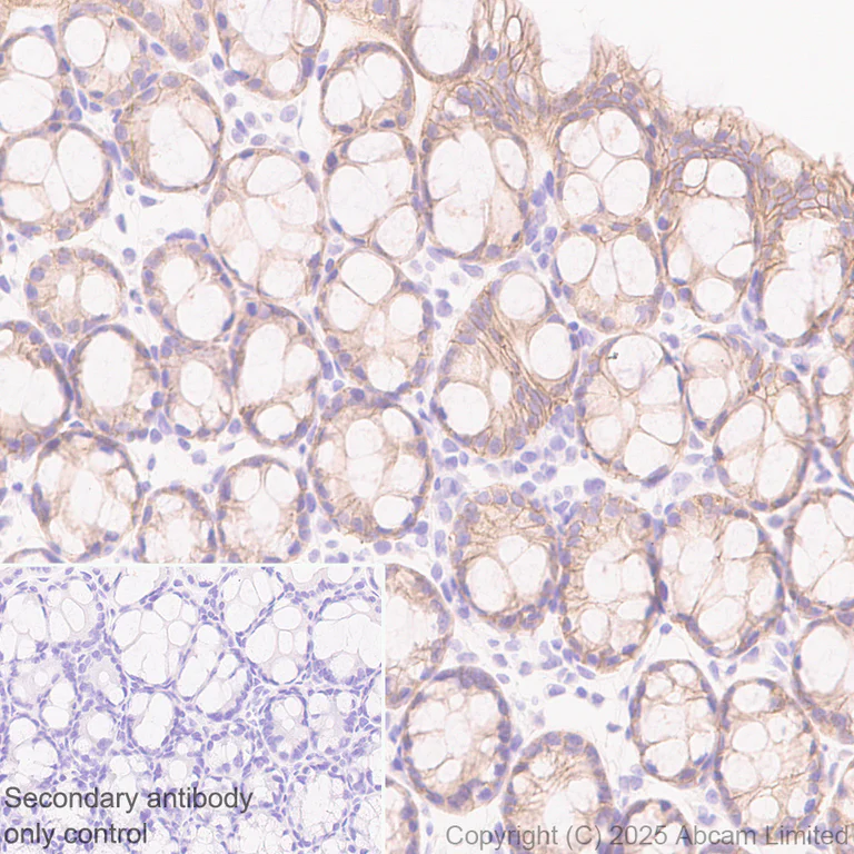Immunohistochemistry (Formalin/PFA-fixed paraffin-embedded sections) - Anti-GPA33 antibody [EPR30348-518] (AB324562)
