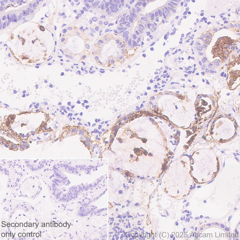 Immunohistochemistry (Formalin/PFA-fixed paraffin-embedded sections) - Anti-GPA33 antibody [EPR30348-518] (AB324562)