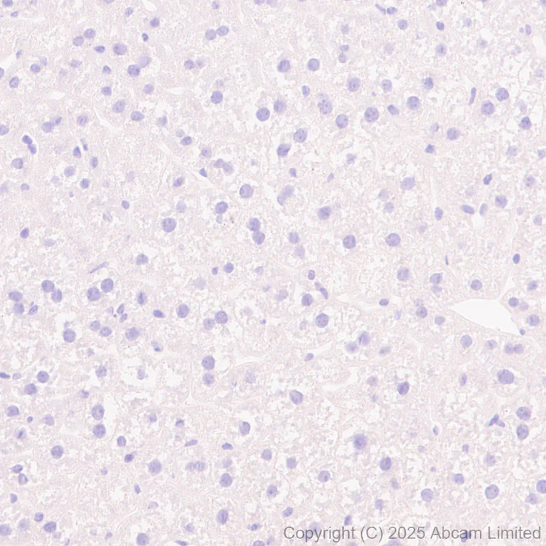 Immunohistochemistry (Formalin/PFA-fixed paraffin-embedded sections) - Anti-GPA33 antibody [EPR30348-518] (AB324562)