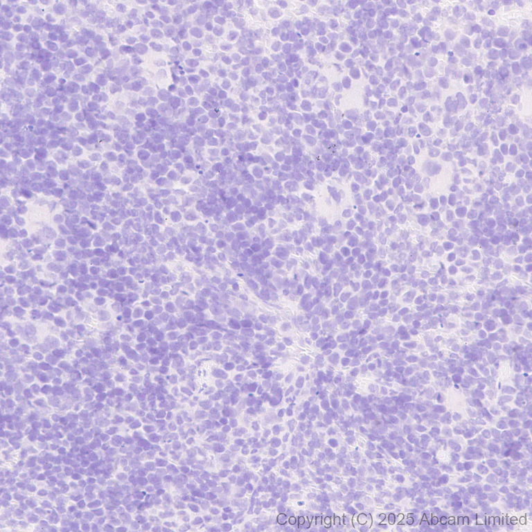 Immunohistochemistry (Formalin/PFA-fixed paraffin-embedded sections) - Anti-GPA33 antibody [EPR30348-518] (AB324562)