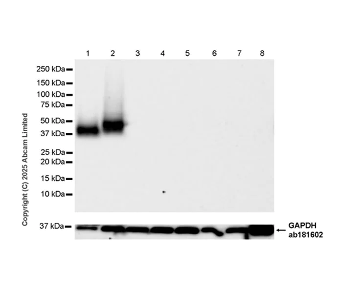 Western blot - Anti-GPA33 antibody [EPR30348-518] (AB324562)