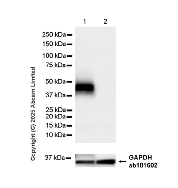 Western blot - Anti-GPA33 antibody [EPR30348-518] (AB324562)