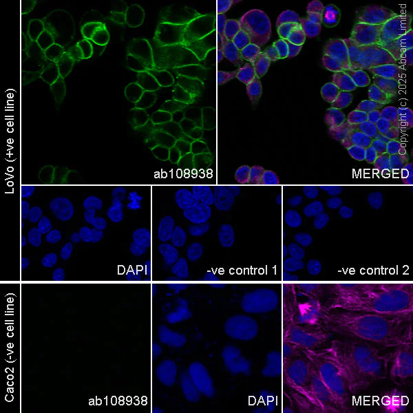 Immunocytochemistry/ Immunofluorescence - Anti-GPA33 antibody [EPR4240] (AB108938)