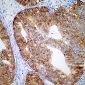 Immunohistochemistry (Formalin/PFA-fixed paraffin-embedded sections) - Anti-GPA33 antibody [EPR4240] (AB108938)