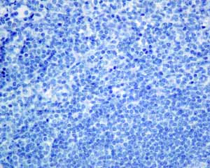 Immunohistochemistry (Formalin/PFA-fixed paraffin-embedded sections) - Anti-GPA33 antibody [EPR4240] (AB108938)