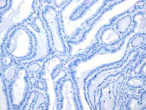 Immunohistochemistry (Formalin/PFA-fixed paraffin-embedded sections) - Anti-GPA33 antibody [EPR4240] (AB108938)
