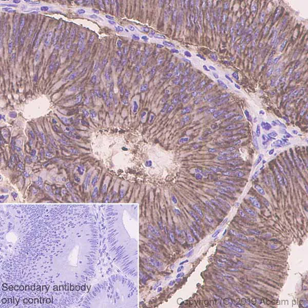Immunohistochemistry (Formalin/PFA-fixed paraffin-embedded sections) - Anti-GPA33 antibody [EPR4240] (AB108938)