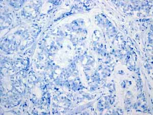 Immunohistochemistry (Formalin/PFA-fixed paraffin-embedded sections) - Anti-GPA33 antibody [EPR4240] (AB108938)