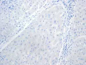 Immunohistochemistry (Formalin/PFA-fixed paraffin-embedded sections) - Anti-GPA33 antibody [EPR4240] (AB108938)