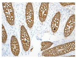 Immunohistochemistry (Formalin/PFA-fixed paraffin-embedded sections) - Anti-GPA33 antibody [EPR4240] (AB108938)