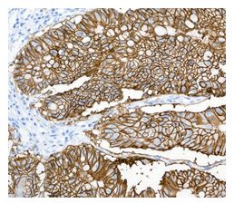 Immunohistochemistry (Formalin/PFA-fixed paraffin-embedded sections) - Anti-GPA33 antibody [EPR4240] (AB108938)