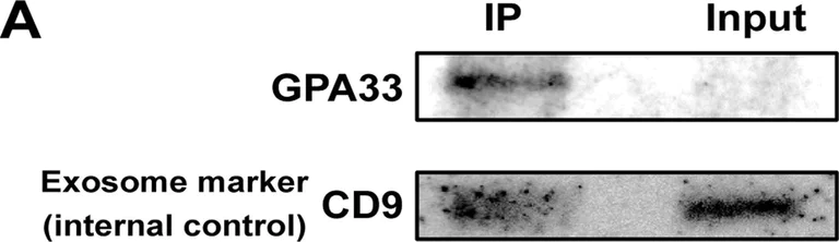 Western blot - Anti-GPA33 antibody [EPR4240] (AB108938)