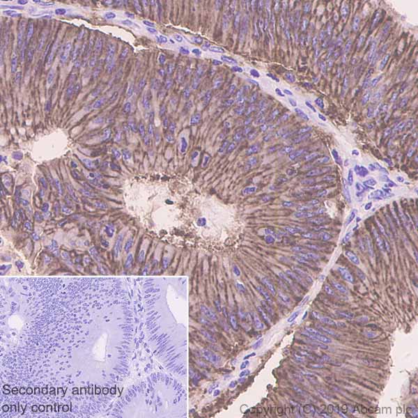 Immunohistochemistry (Formalin/PFA-fixed paraffin-embedded sections) - Anti-GPA33 antibody [EPR4240] - BSA and Azide free (AB247720)