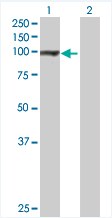 Western blot - Anti-GPAM antibody (AB68925)