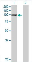 Western blot - Anti-GPAM antibody (AB68925)