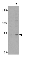 Western blot - Anti-GPAM antibody (AB69990)