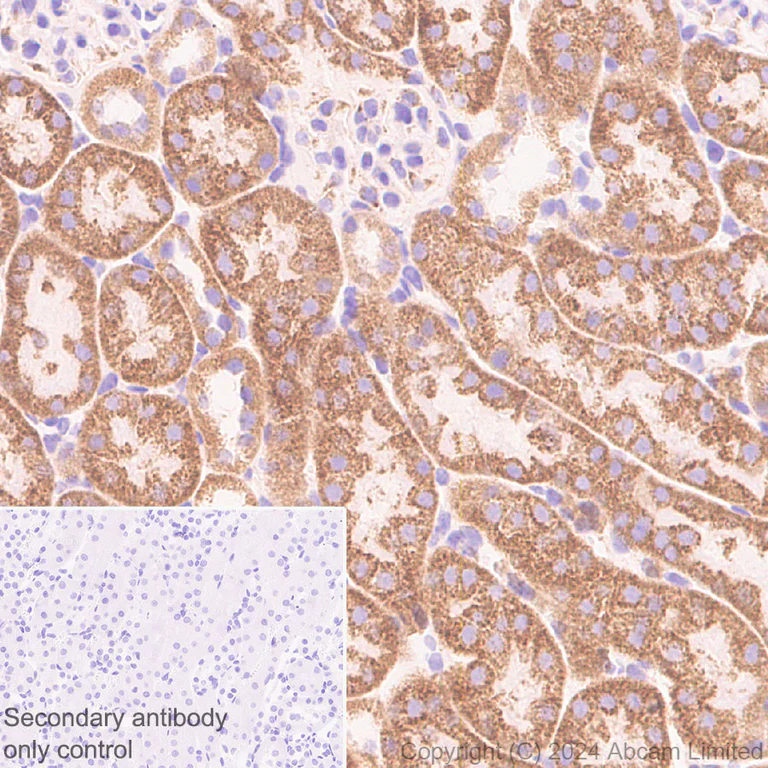 Immunohistochemistry (Formalin/PFA-fixed paraffin-embedded sections) - Anti-GPAM antibody [EPR29023-506] (AB322201)
