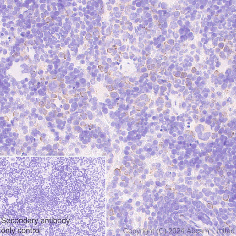Immunohistochemistry (Formalin/PFA-fixed paraffin-embedded sections) - Anti-GPAM antibody [EPR29023-506] (AB322201)