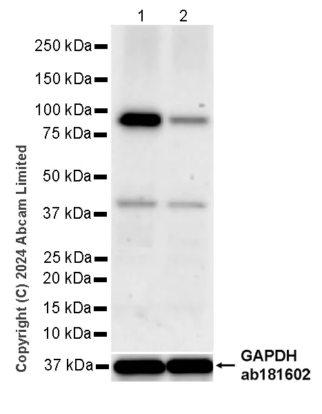 Western blot - Anti-GPAM antibody [EPR29023-506] (AB322201)