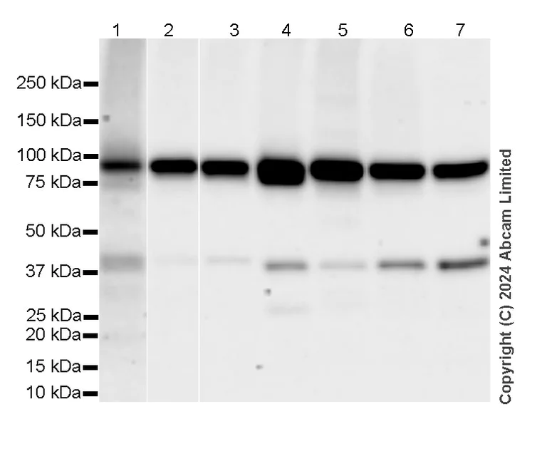 Western blot - Anti-GPAM antibody [EPR29023-506] (AB322201)