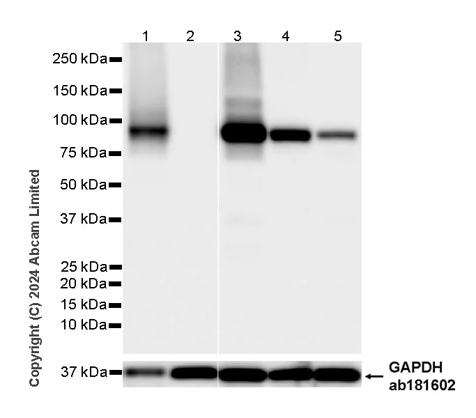 Western blot - Anti-GPAM antibody [EPR29023-506] (AB322201)
