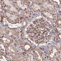 Immunohistochemistry (Formalin/PFA-fixed paraffin-embedded sections) - Anti-GPATCH1 antibody (AB130413)