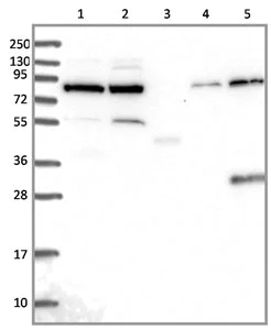 Western blot - Anti-GPATCH1 antibody (AB130413)