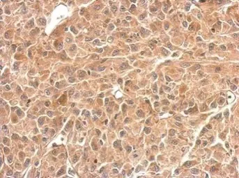 Immunohistochemistry (Formalin/PFA-fixed paraffin-embedded sections) - Anti-GPBB antibody (AB154969)