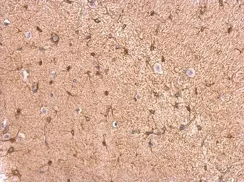 Immunohistochemistry (Formalin/PFA-fixed paraffin-embedded sections) - Anti-GPBB antibody (AB154969)