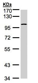 Western blot - Anti-GPBB antibody (AB154969), expandable thumbnail