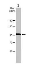 Western blot - Anti-GPBB antibody (AB154969)