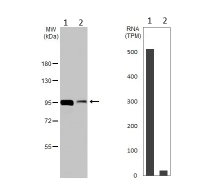 Western blot - Anti-GPBB antibody (AB154969)