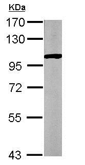 Western blot - Anti-GPBB antibody (AB154969), expandable thumbnail
