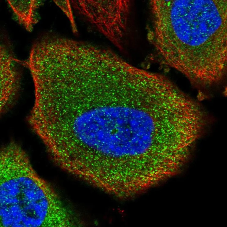 Immunocytochemistry/ Immunofluorescence - Anti-GPBB antibody (AB251810)